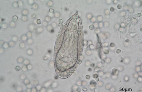 A magnified photo of Schistosoma haematobium